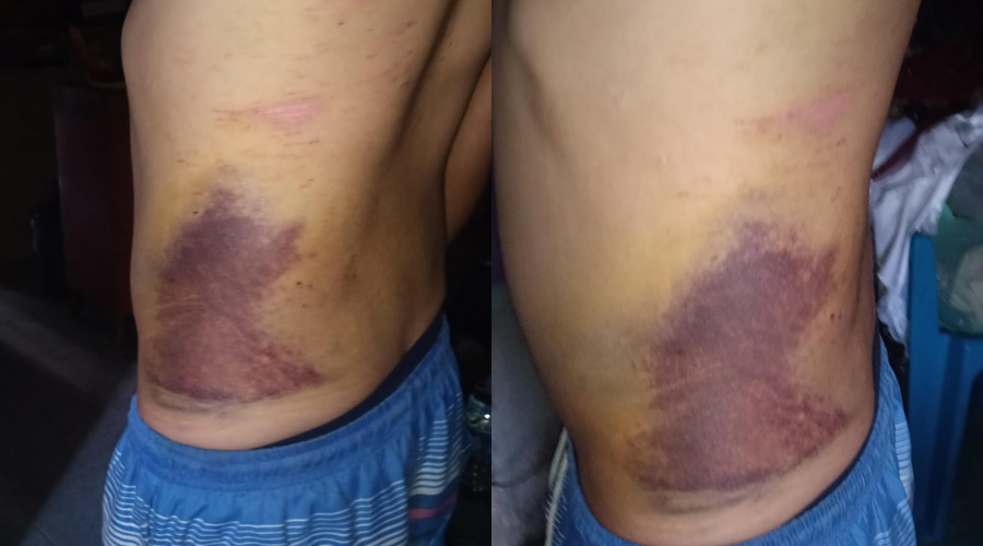 El comandante Gamboa causa un accidente y deja herido a un motociclistaLo oculta
