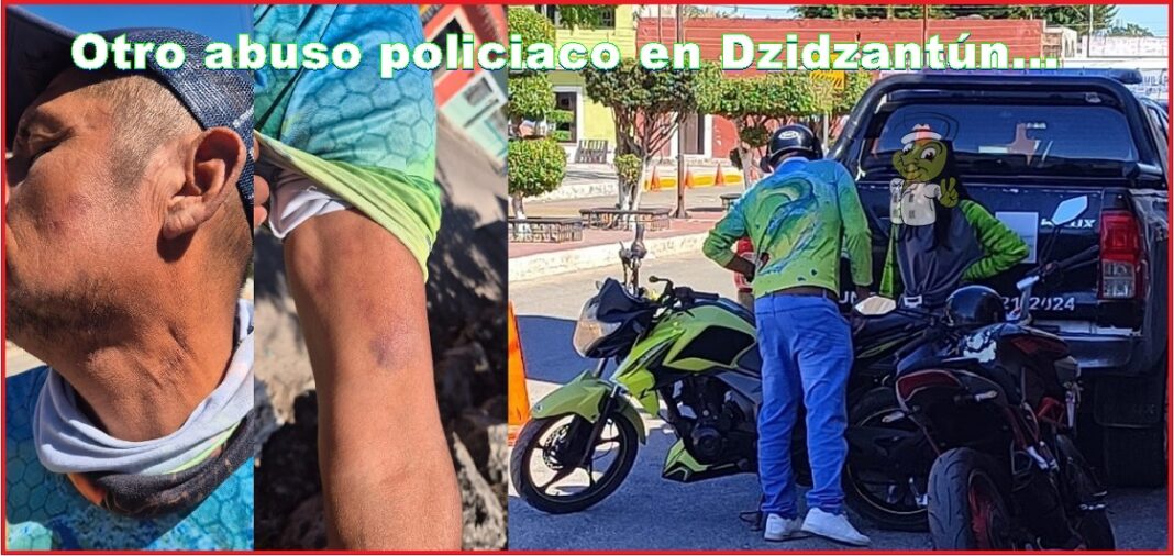 1PoliDzidz