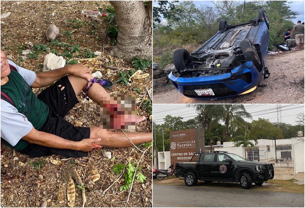 XIXpoli Por bajar ciruela sufre fractura expuesta